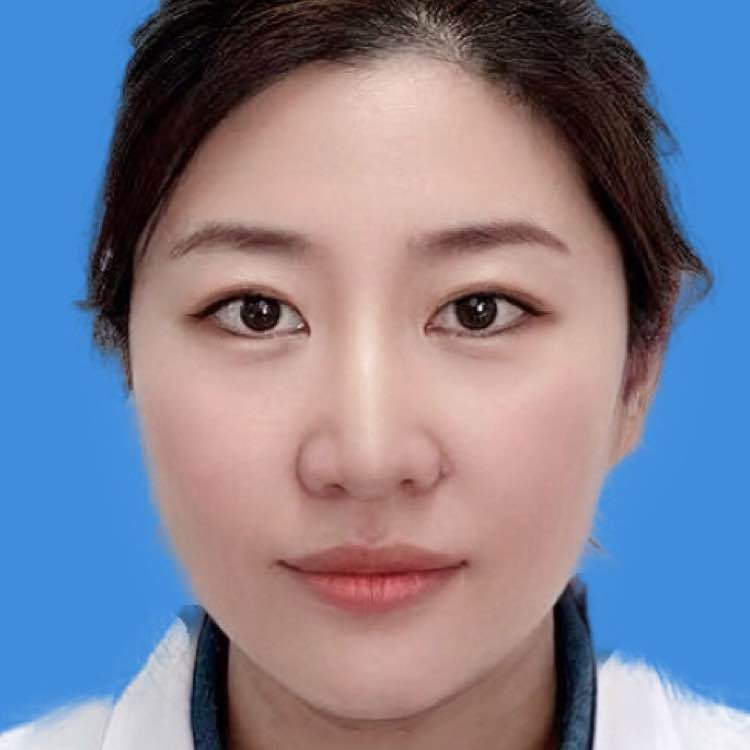 刘娇