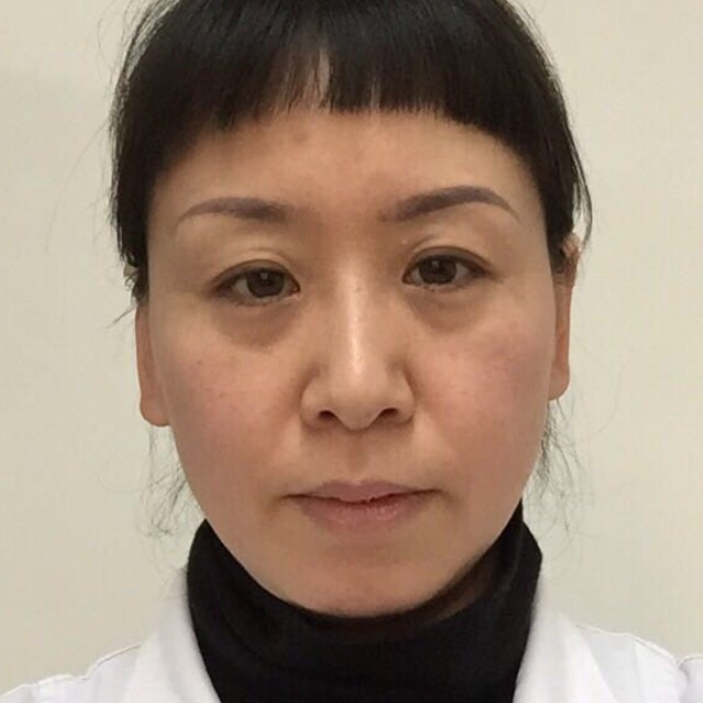 杨月艳