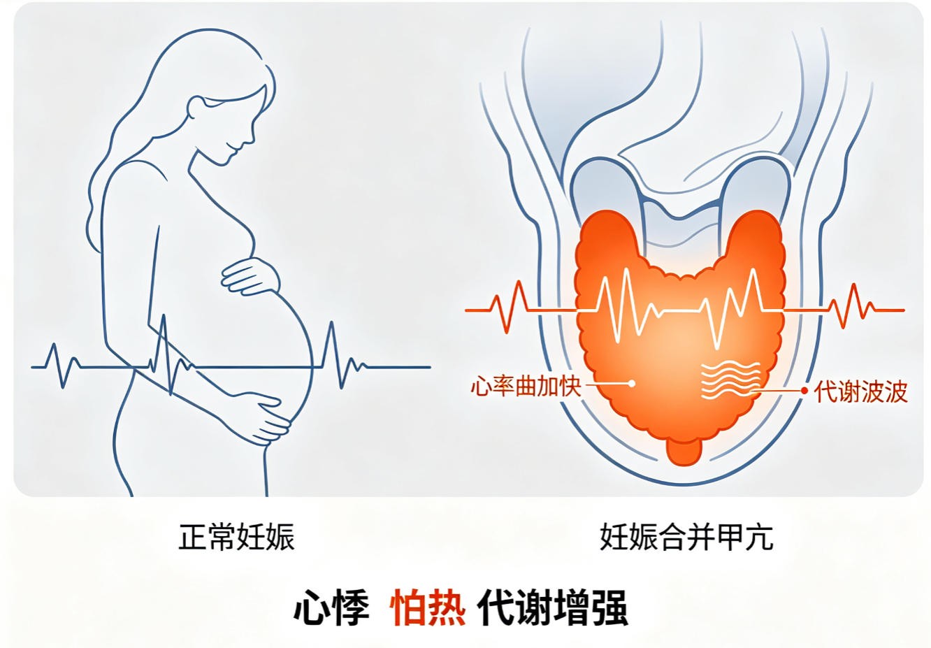 妊娠合并甲亢