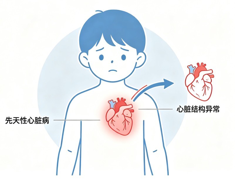小儿先天性心脏病