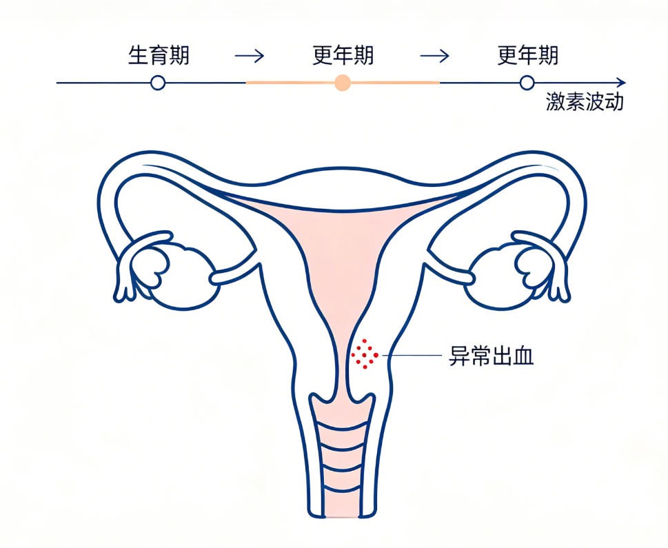 更年期功能失调性子宫出血