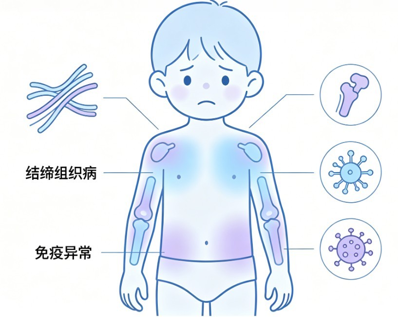 小儿结缔组织病