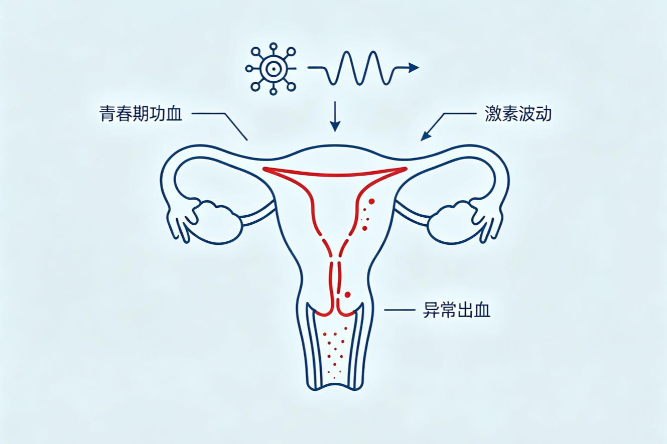 青春期功能失调性子宫出血