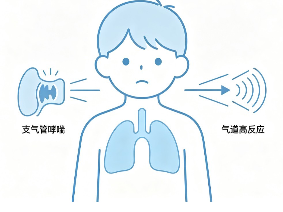小儿支气管哮喘