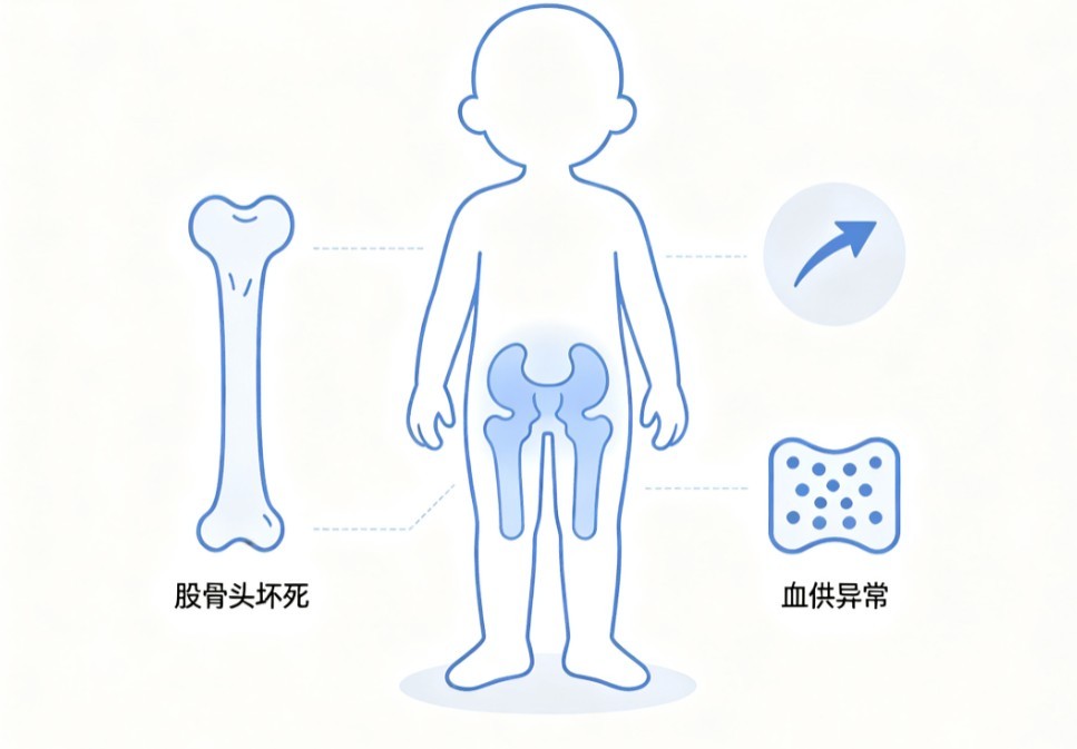 儿童股骨头坏死