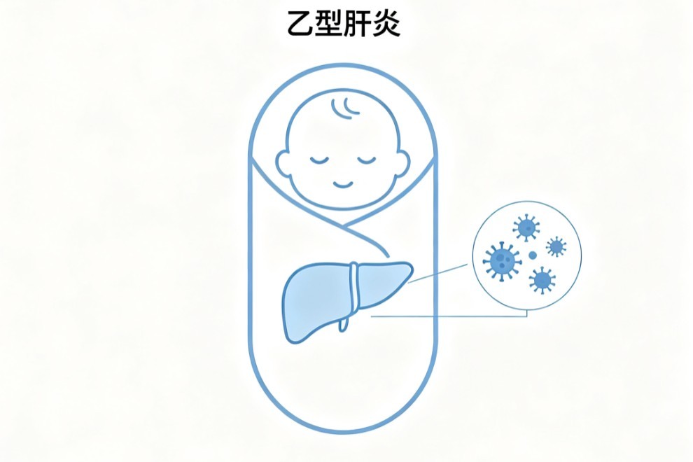 新生儿乙型肝炎