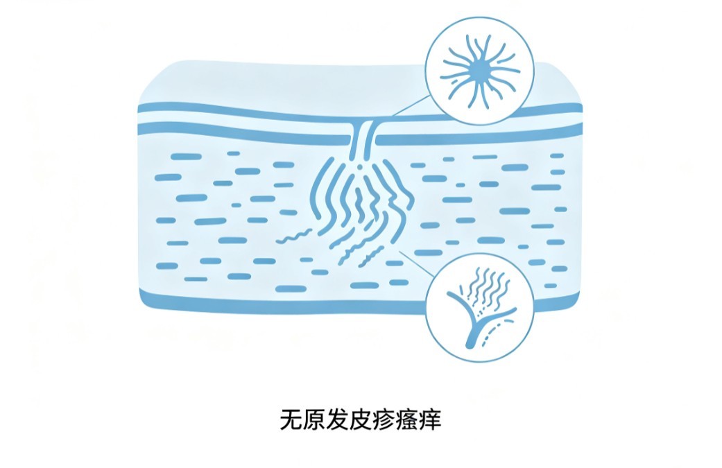 风瘙痒