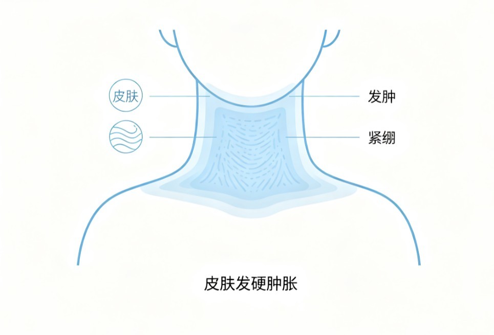 成人硬肿症