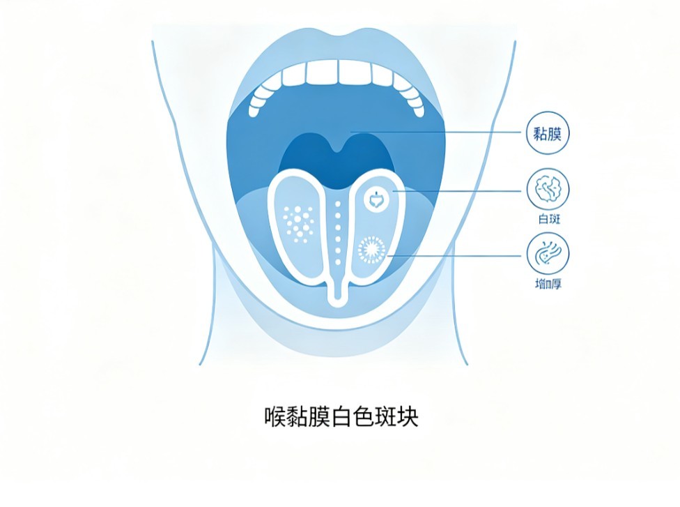 喉白斑病