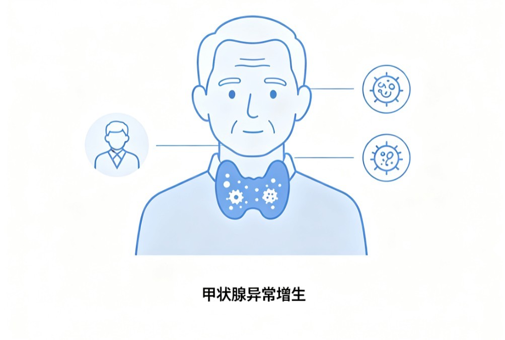 老年甲状腺癌