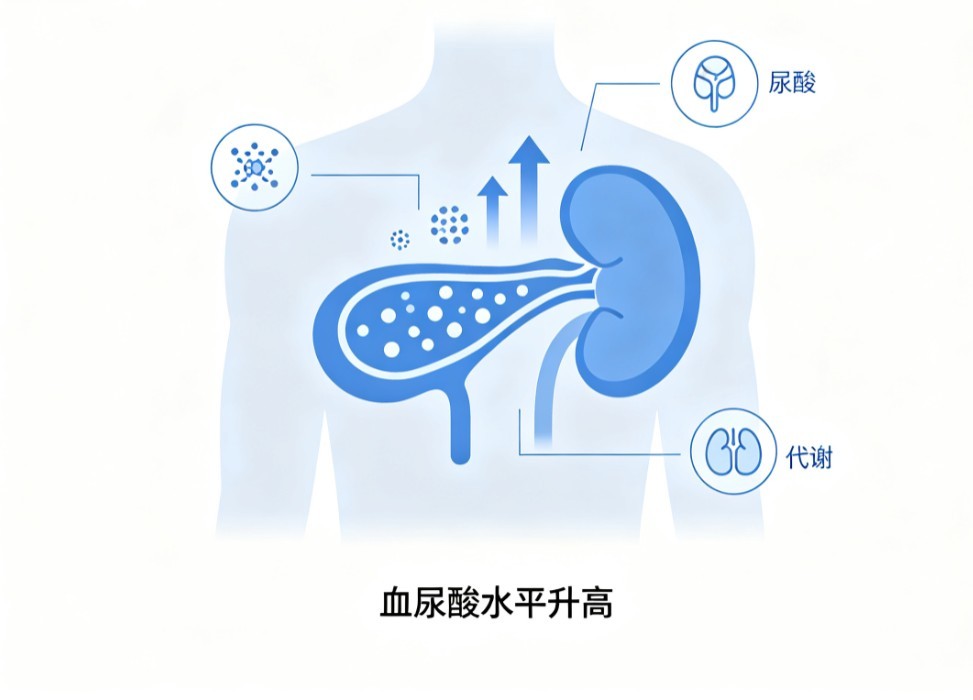 高尿酸血症