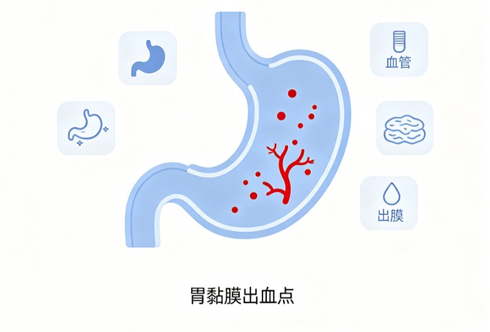 胃出血
