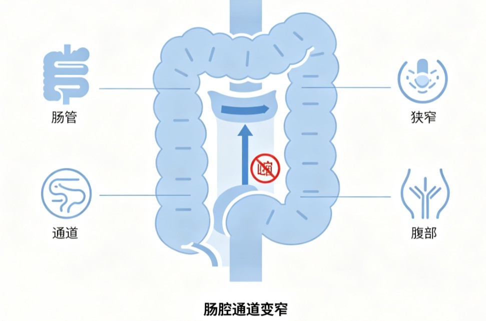 肠狭窄