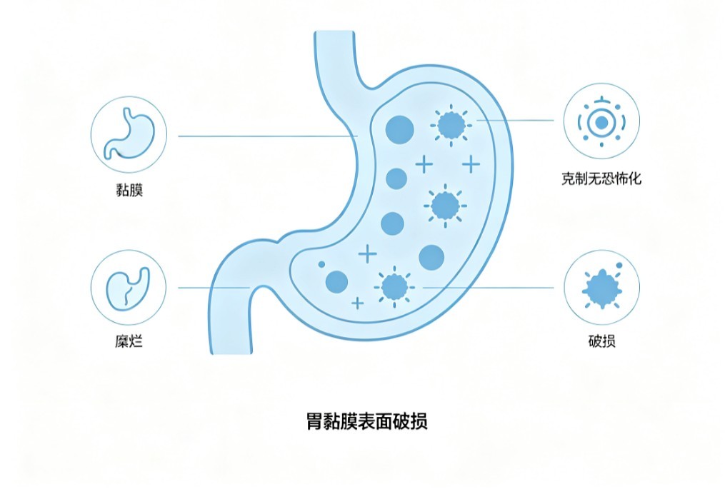 糜烂性胃炎