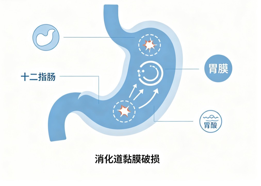 消化道溃疡