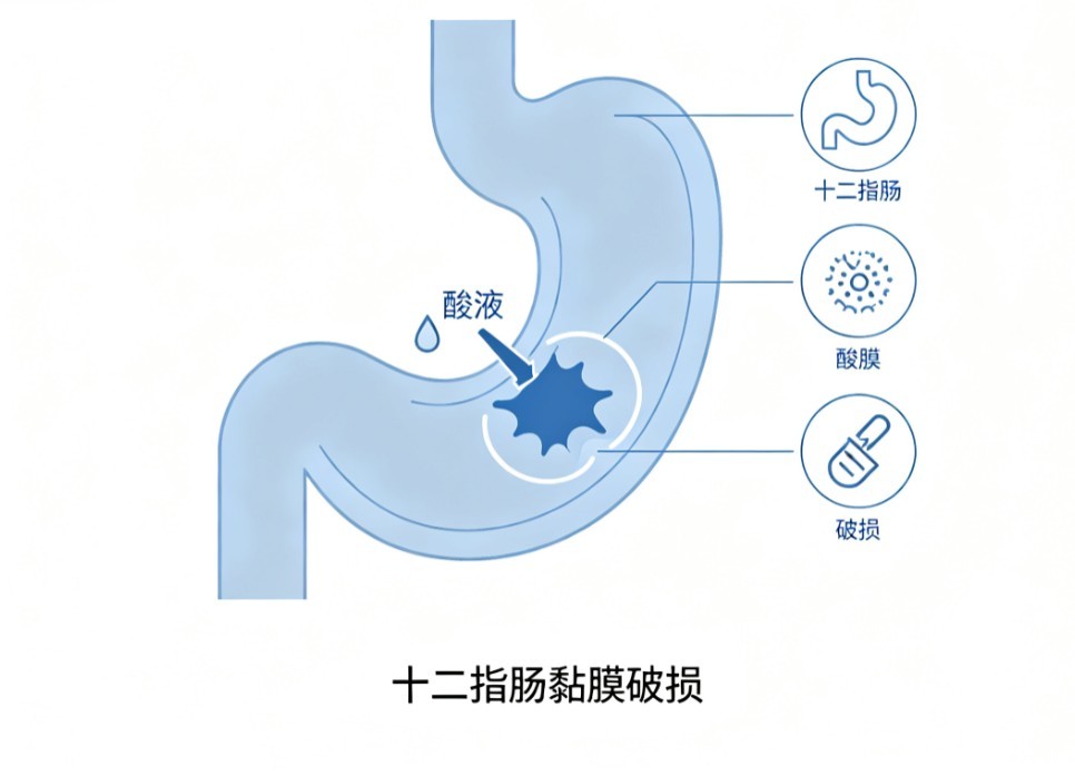 结肠过敏症