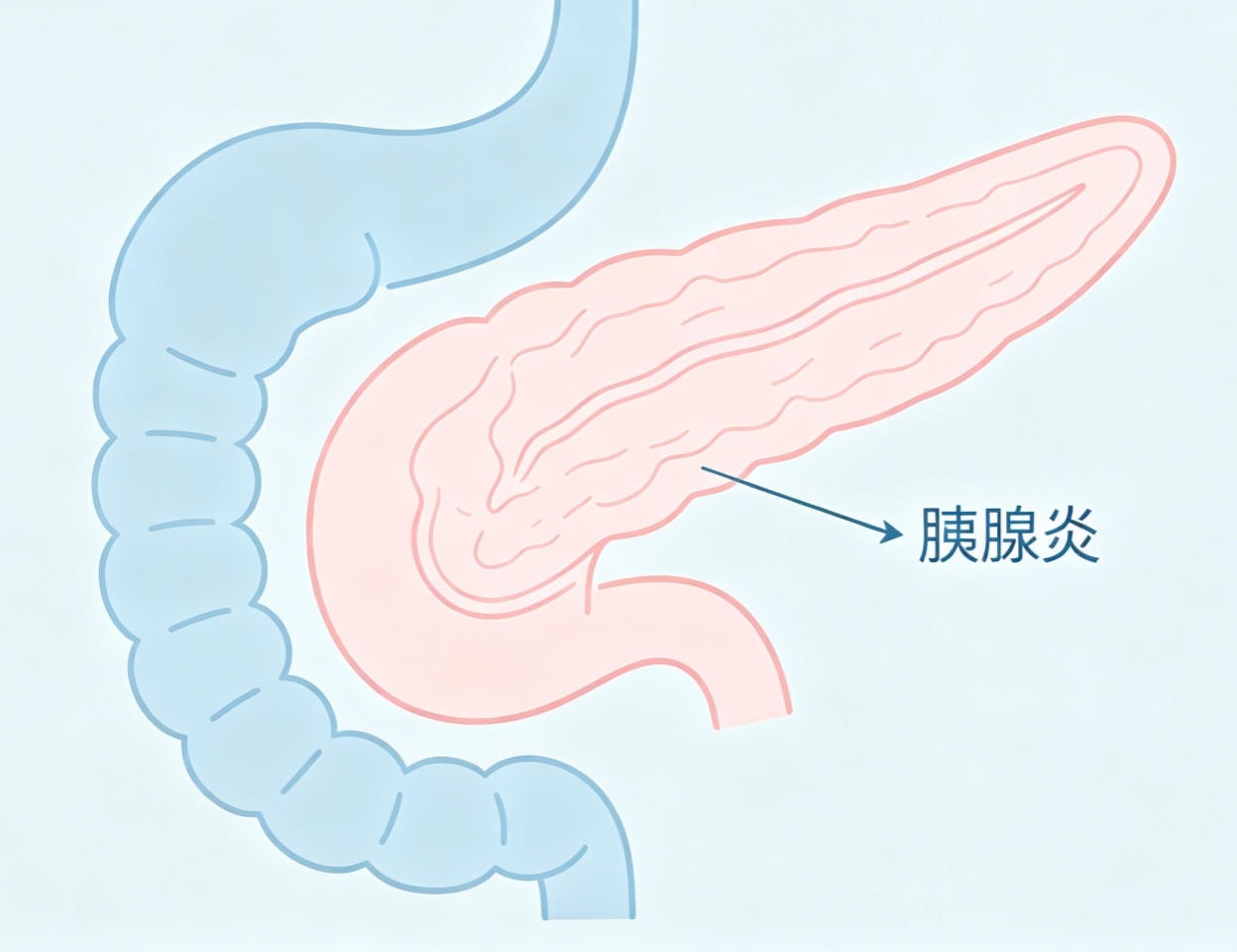 胰腺炎