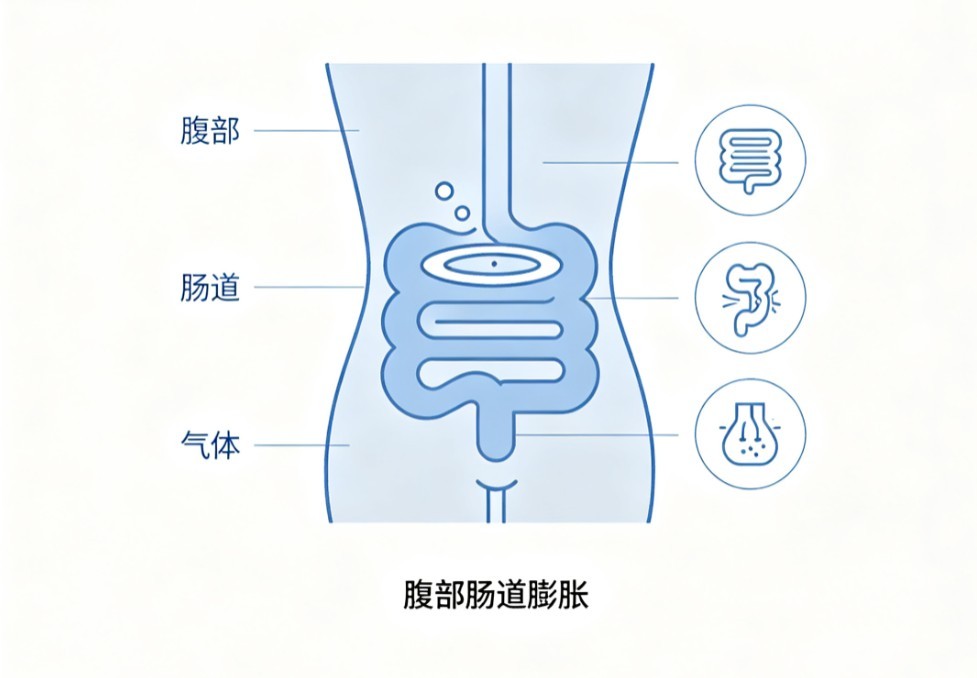 腹胀