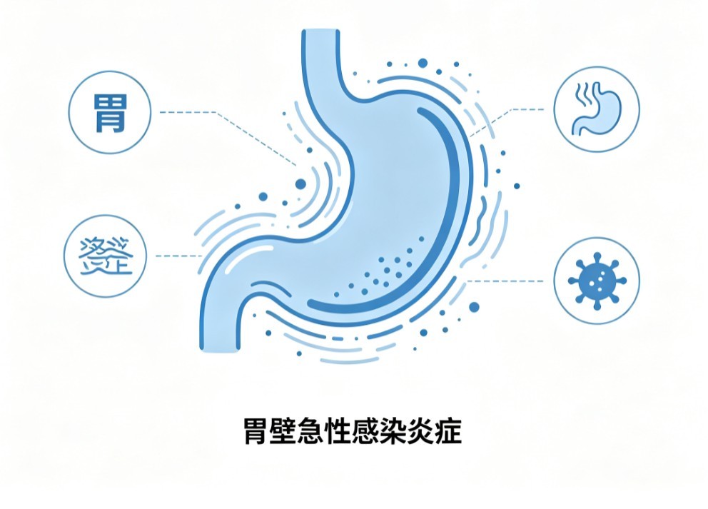 急性单纯性胃炎