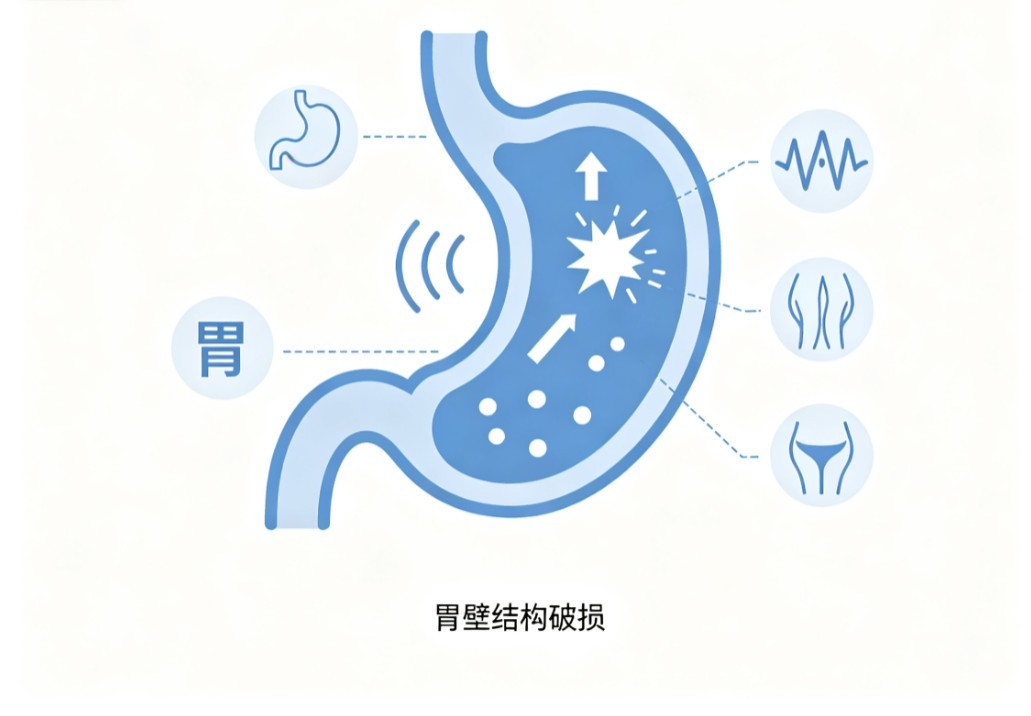 胃穿孔
