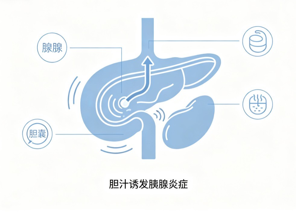 胆源性慢性胰腺炎