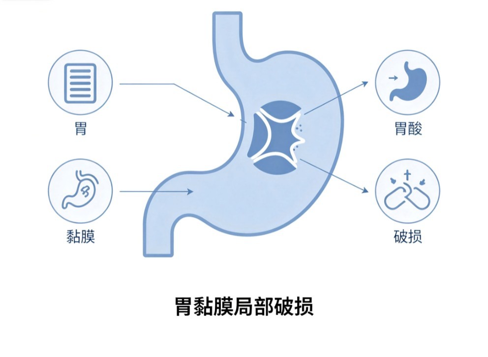 甲型肝炎