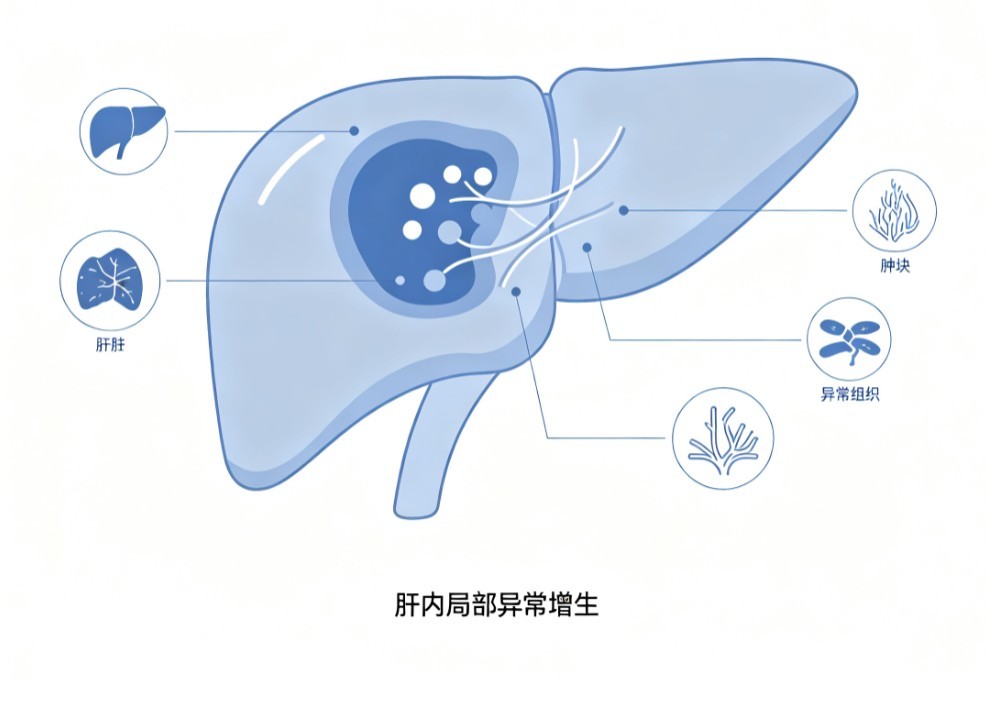 肝肿瘤