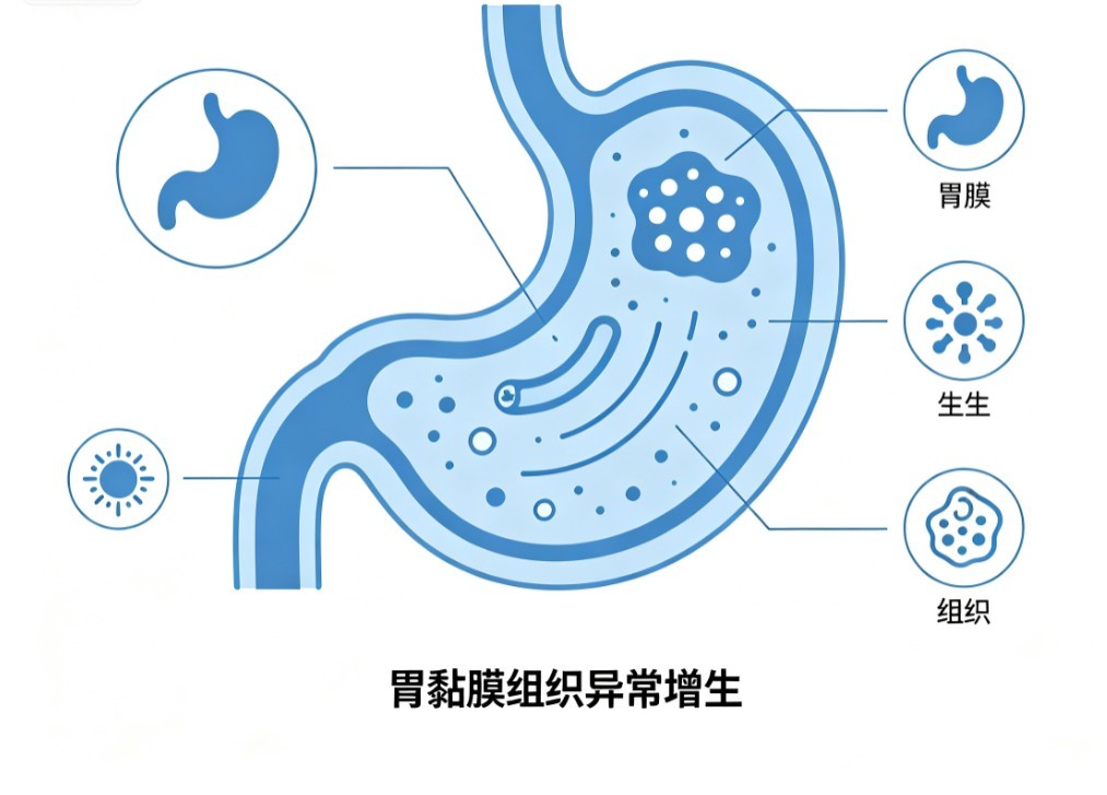 胃癌