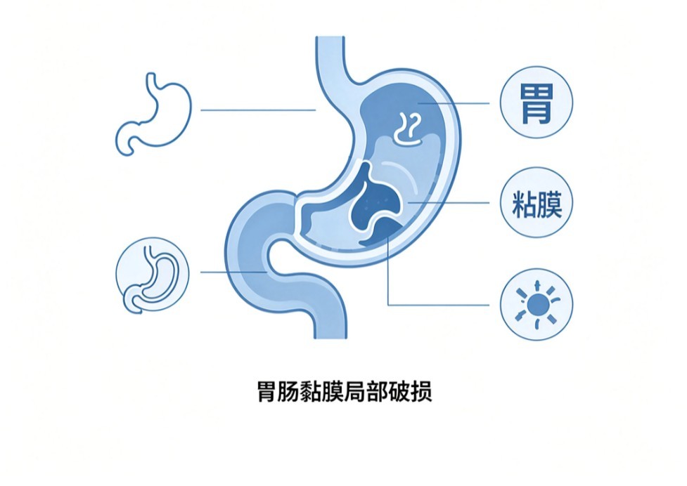 家族性结肠息肉