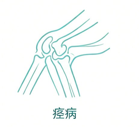 痉病