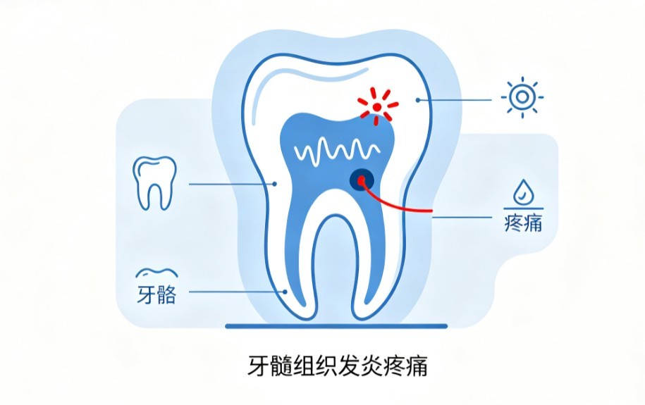 牙髓炎