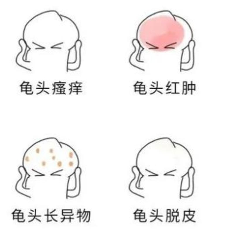 龟头炎