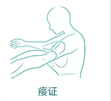 痿证
