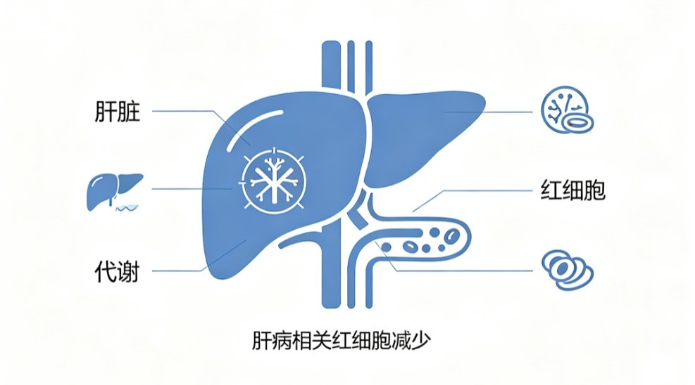 肝脏疾病所致贫血