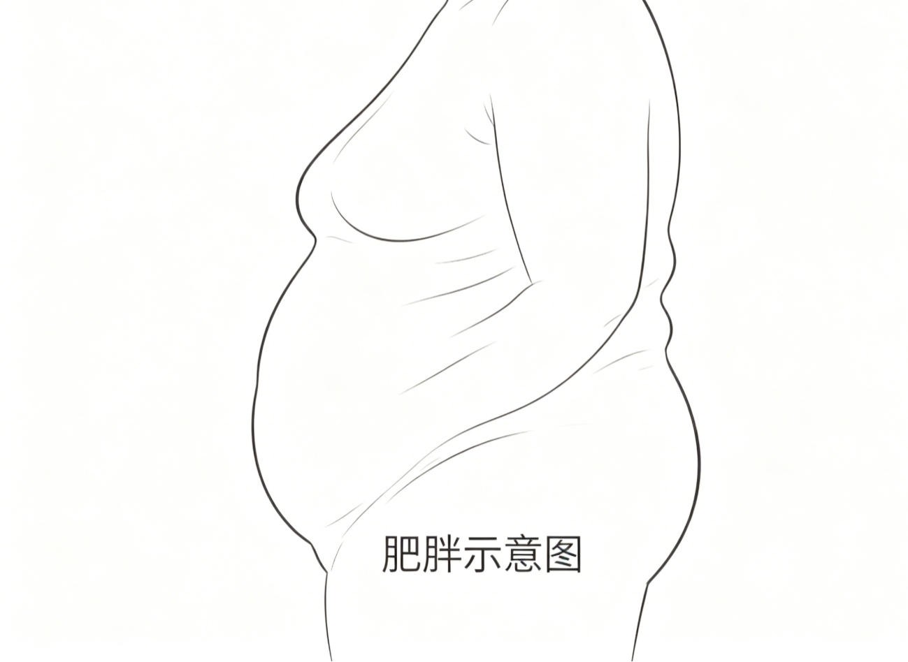 肥胖