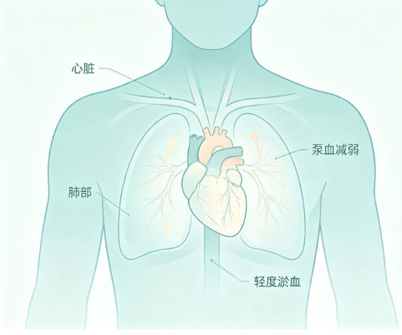 急性心力衰竭