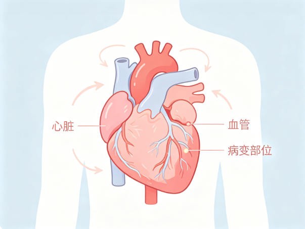 心脏病