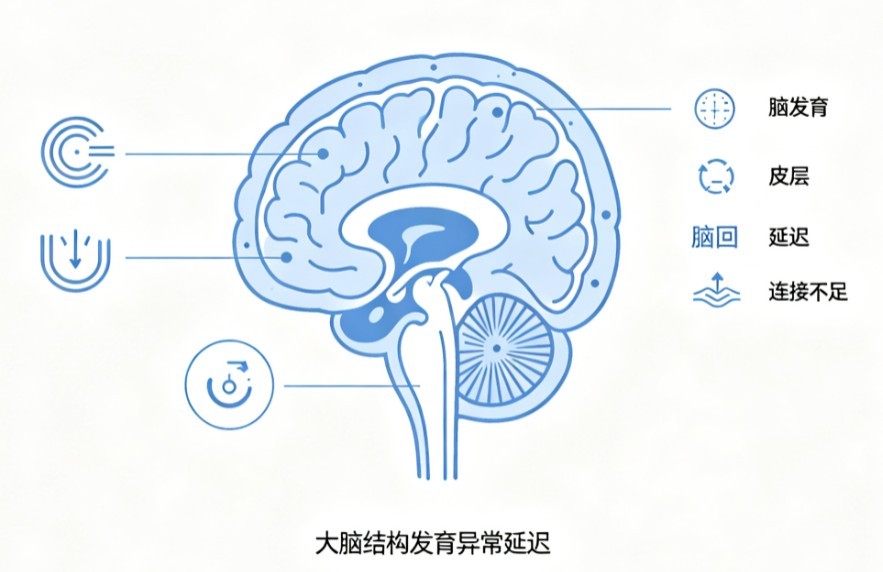 脑发育不良