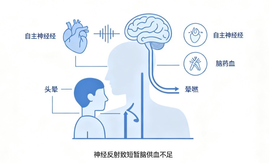 反射性晕厥