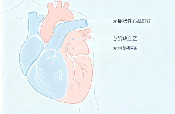 老年无症状性心肌缺血