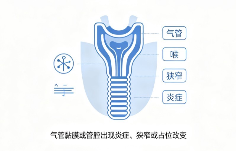 气管疾病