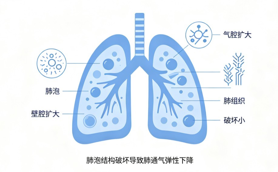 肺气肿