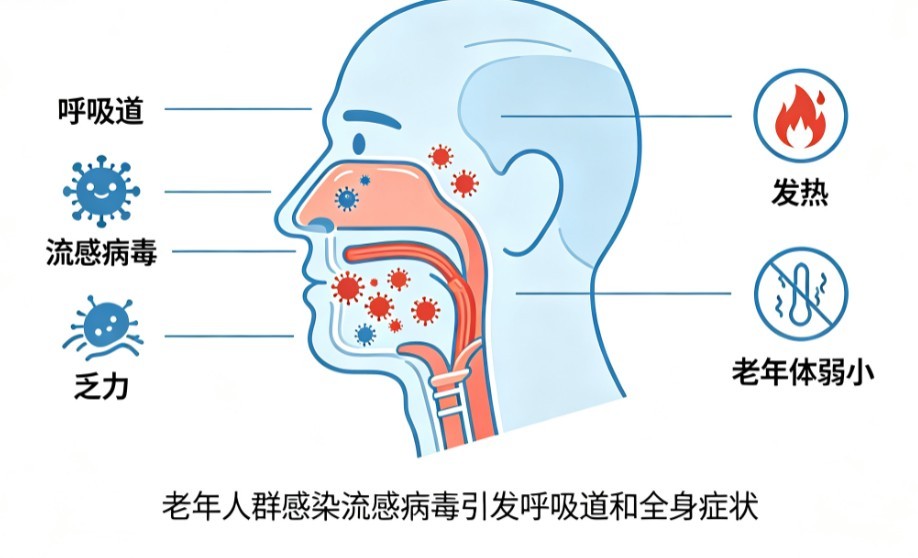 老年流行性感冒