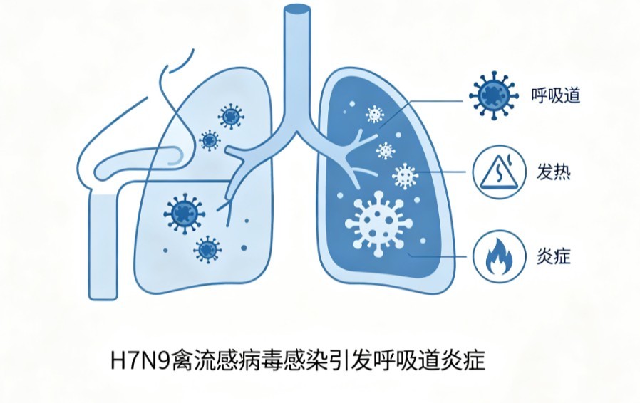 H7N9 型禽流感