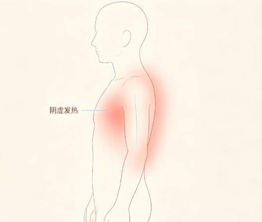 阴虚发热