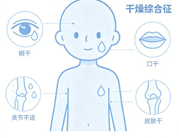 干燥综合征