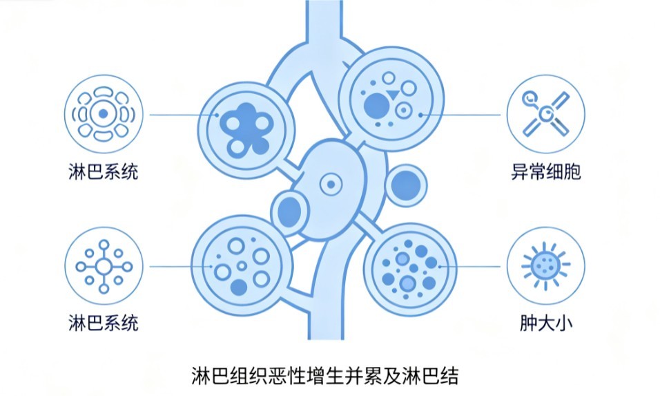 淋巴瘤