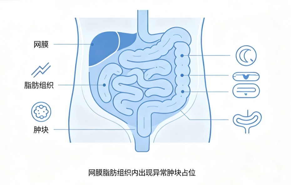 网膜肿瘤