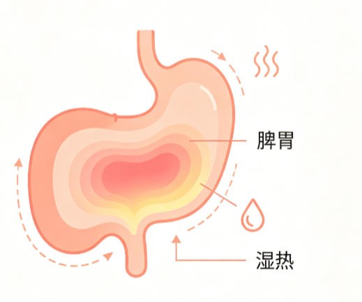 脾胃湿热