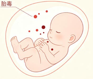 胎毒